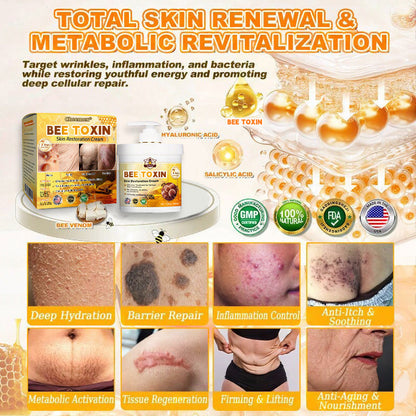 🐝🔥FDA Approved|Cheemex® Bee Venom Skin Restoration Cream (Anti-aging, Hydrating, Skin Repair, Even Tone, Acne and Dark Spot Treatment, Wart and Mole Removal, Psoriasis Relief)