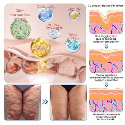 us👩‍⚕️Cheemex® Advanced Botulinum Toxin Peptide Retinol Firming & Lifting Cream⏰LAST DAY 50% OFF