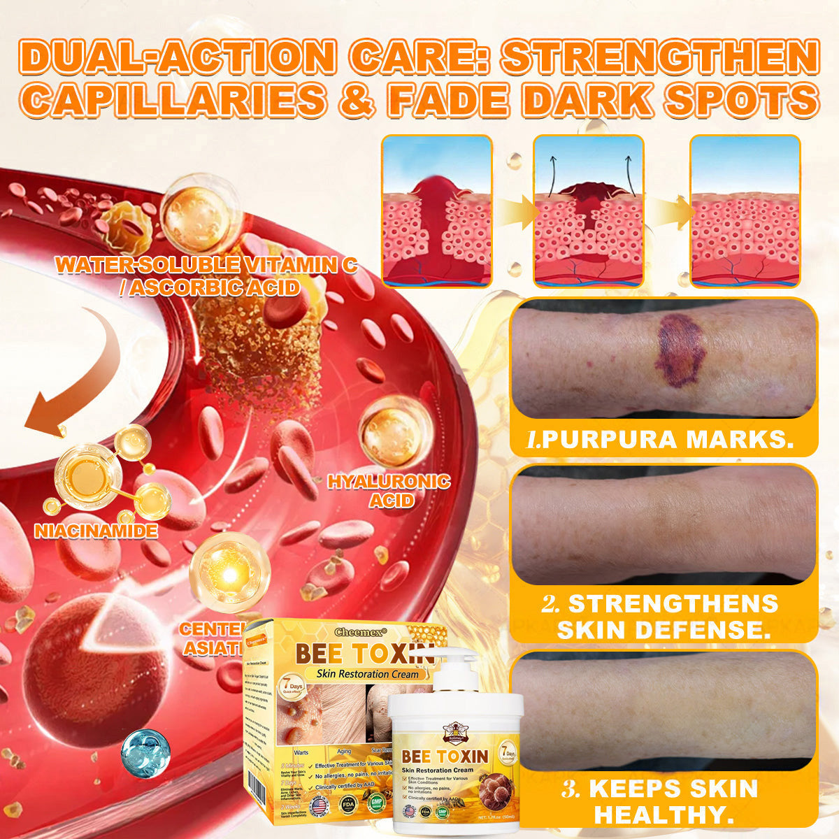 🐝🔥FDA Approved|Cheemex® Bee Venom Skin Restoration Cream (Anti-aging, Hydrating, Skin Repair, Even Tone, Acne and Dark Spot Treatment, Wart and Mole Removal, Psoriasis Relief)