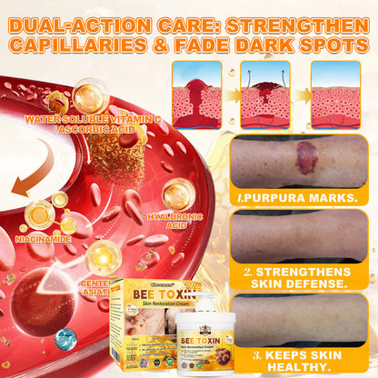 🐝🔥FDA Approved|Cheemex® Bee Venom Skin Restoration Cream (Anti-aging, Hydrating, Skin Repair, Even Tone, Acne and Dark Spot Treatment, Wart and Mole Removal, Psoriasis Relief)