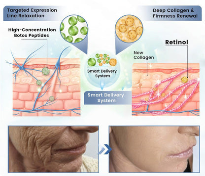 us👩‍⚕️Cheemex® Advanced Botulinum Toxin Peptide Retinol Firming & Lifting Cream⏰LAST DAY 50% OFF
