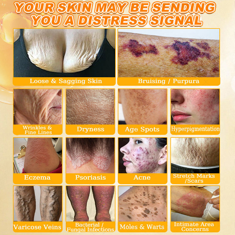 🐝🔥FDA Approved|Cheemex® Bee Venom Skin Restoration Cream (Anti-aging, Hydrating, Skin Repair, Even Tone, Acne and Dark Spot Treatment, Wart and Mole Removal, Psoriasis Relief)