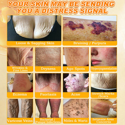 🐝🔥FDA Approved|Cheemex® Bee Venom Skin Restoration Cream (Anti-aging, Hydrating, Skin Repair, Even Tone, Acne and Dark Spot Treatment, Wart and Mole Removal, Psoriasis Relief)