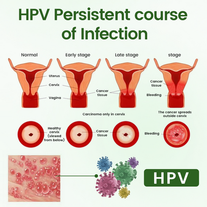 Cheemex® FeminaDefend All-In-One Intimate Therapy Pads