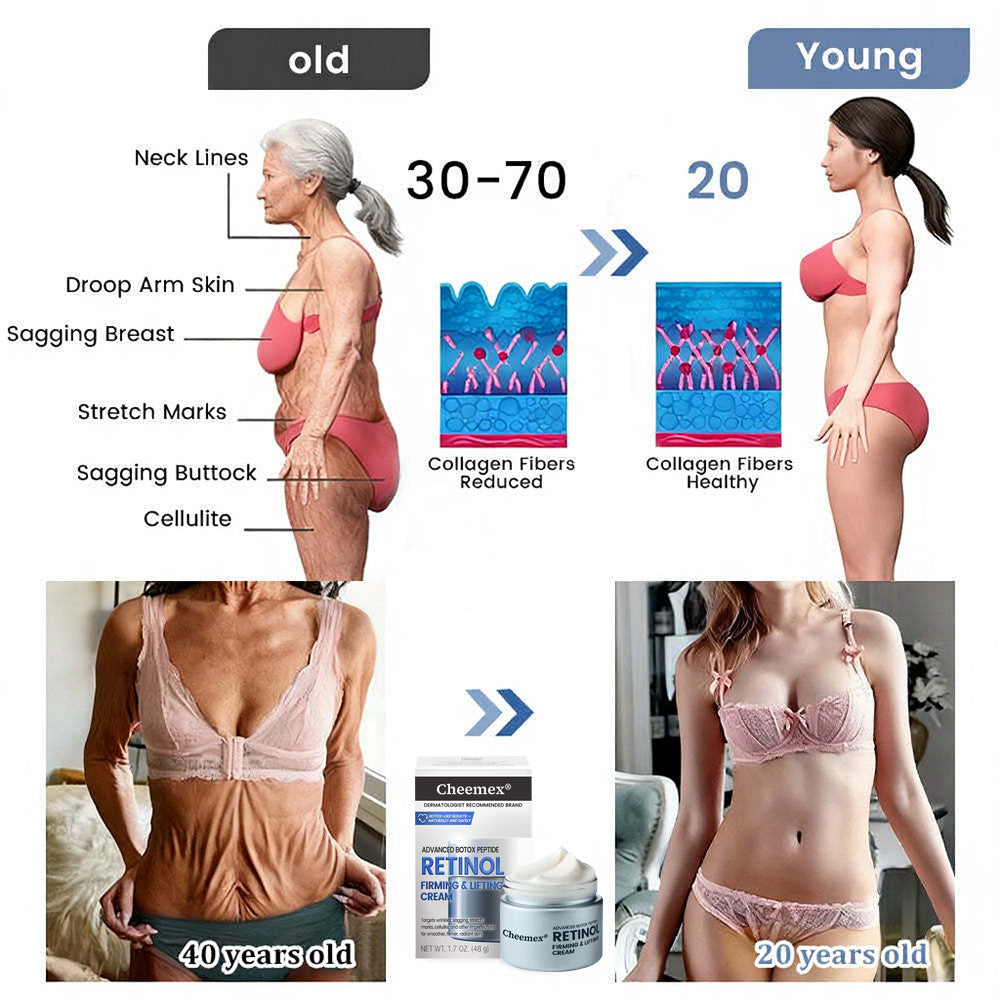 us👩‍⚕️Cheemex® Advanced Botulinum Toxin Peptide Retinol Firming & Lifting Cream⏰LAST DAY 50% OFF