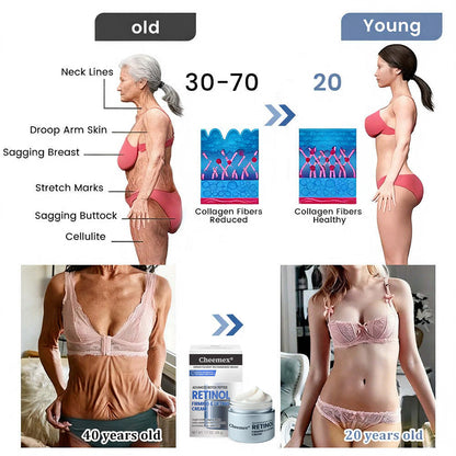 us👩‍⚕️Cheemex® Advanced Botulinum Toxin Peptide Retinol Firming & Lifting Cream⏰LAST DAY 50% OFF