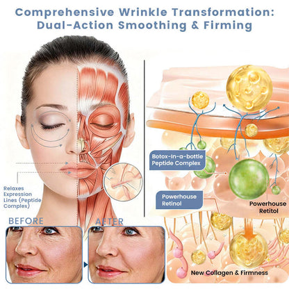 us👩‍⚕️Cheemex® Advanced Botulinum Toxin Peptide Retinol Firming & Lifting Cream⏰LAST DAY 50% OFF
