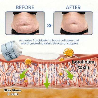 us👩‍⚕️Cheemex® Advanced Botulinum Toxin Peptide Retinol Firming & Lifting Cream⏰LAST DAY 50% OFF