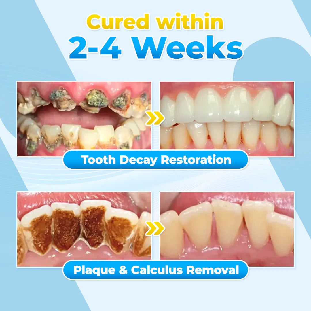 BBOJI™ Bee Venom Gum Repair Powder 🐝 (ADA Approved) 🎁 Flash Sale – Restore Teeth & Gums Now!