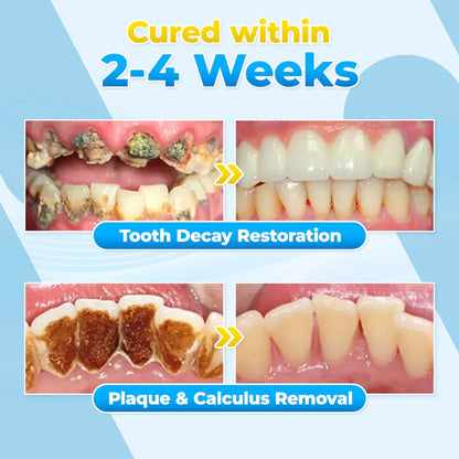 BBOJI™ Bee Venom Gum Repair Powder 🐝 (ADA Approved) 🎁 Flash Sale – Restore Teeth & Gums Now!